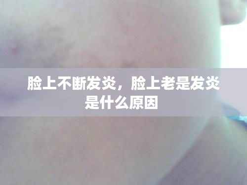 脸上不断发炎,脸上老是发炎是什么原因